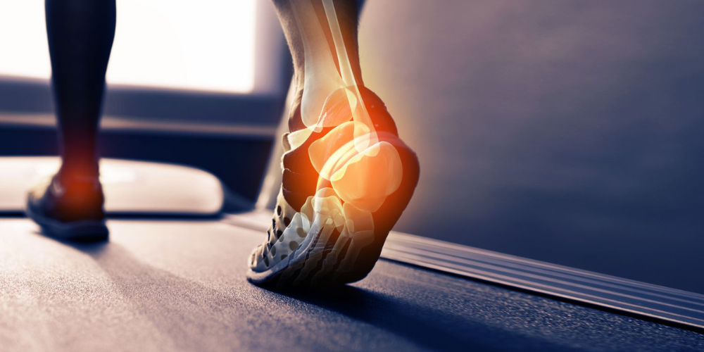 The Long-Term Benefits of Investing in Supportive Insoles for High Arches and Heavy Weights